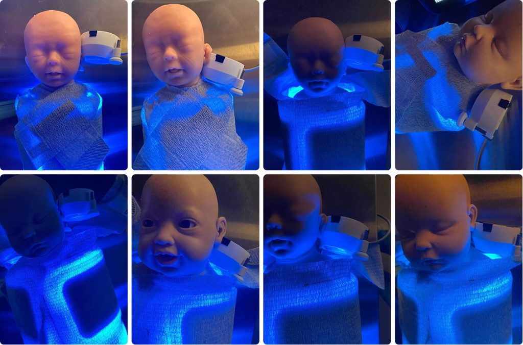 different angles showing 'light blocking' tests of the Snuglit phototherapy medical device unit on the infant mannequins