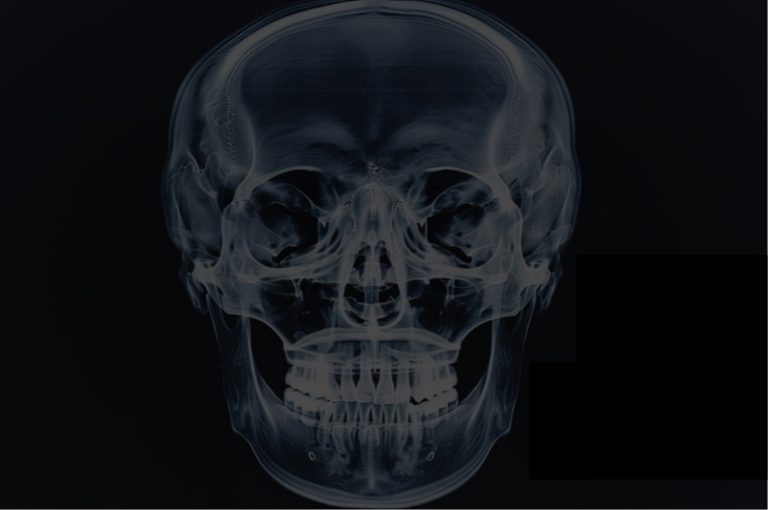 face x ray