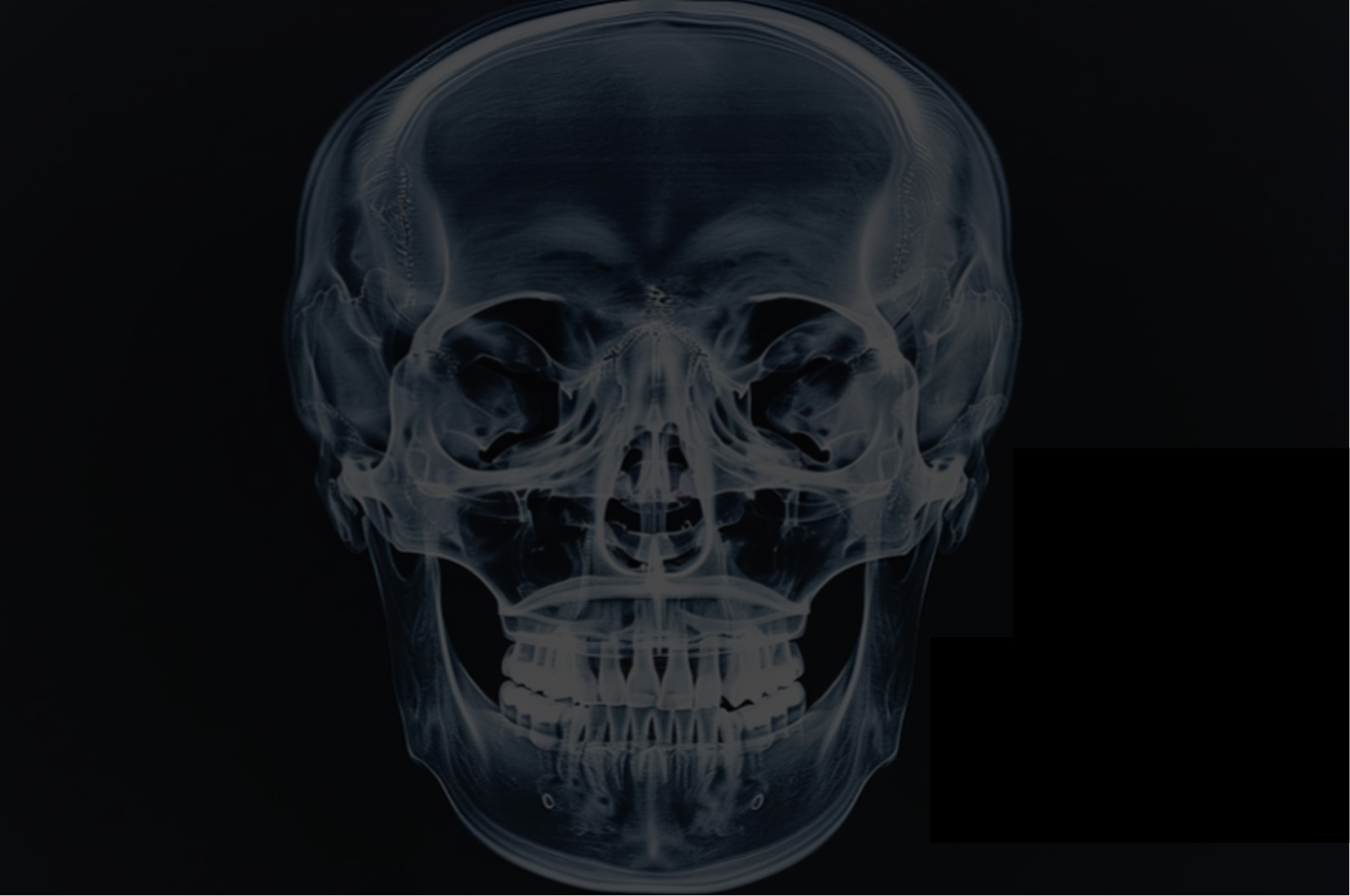 face x ray